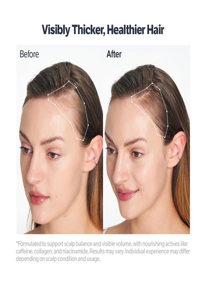 SUNGBOON EDITOR Deep Collagen Retinol Scalp Serum |Roll-On Hair Growth&Thickening Serum |Dry, Itchy Scalp Treatment |Caffeine +Biotin +Rosemary |Korean Hair Care,0.5 fl oz - Image 3